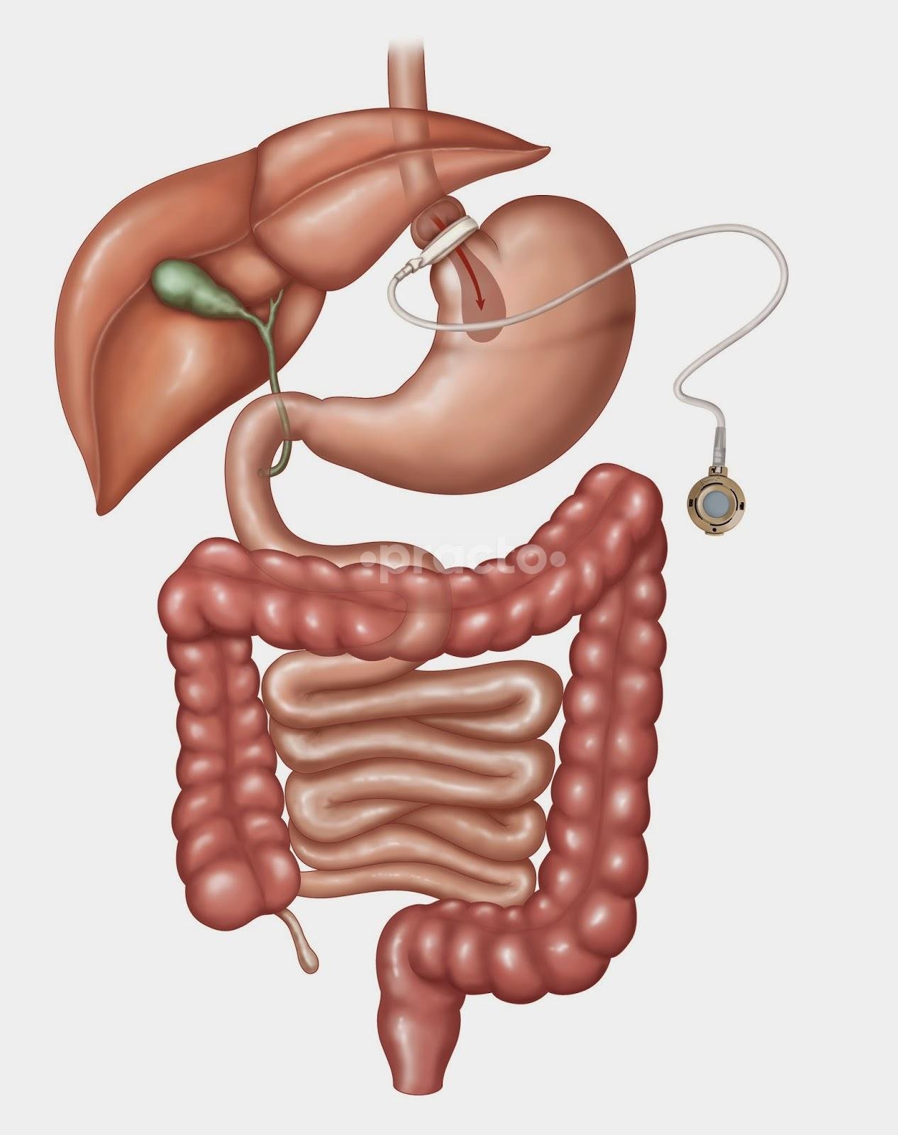 Evaluation for Gastro - Esophageal Reflux Disease